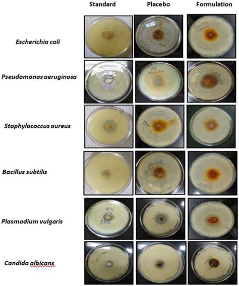Disc Diffusion Method Kit 的图像结果