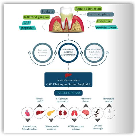 Impact of Intermittent Fasting on Metabolic Syndrome and Periodontal ...