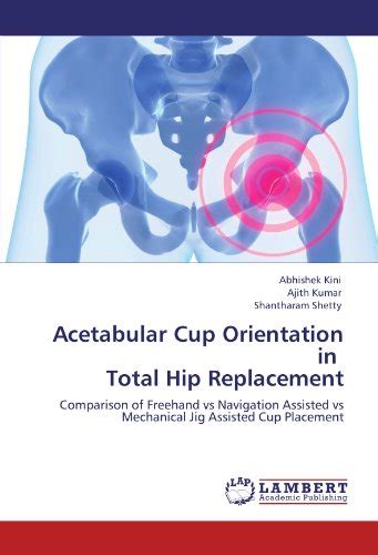 Buy Acetabular Cup Orientation in Total Hip Replacement: Comparison of ...