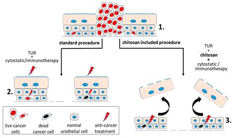 The Use of Polymer Chitosan in Intravesical Treatment of Urinary ...