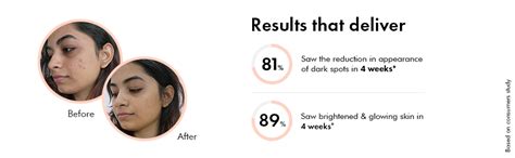 SUGANDA SKINCARE 10% Niacinamide Serum With Hyaluronic Acid And ...