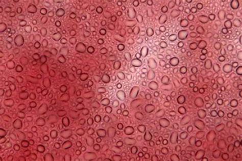 Image result for Explain Red Cell Production