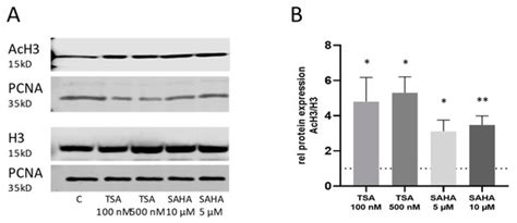 Inhibition of HDAC Enzymes Contributes to Differential Expression of ...