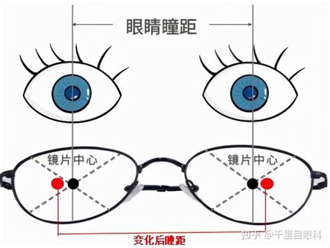 6种瞳距测量大全_亿超眼镜网