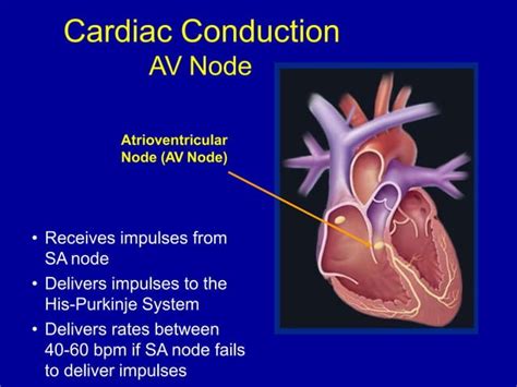 Image result for Cardiac Conduction Disorders Examples