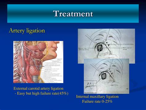 Rezultat imagine pentru ENT Problems