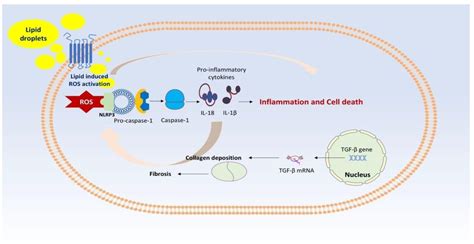 NAFLD in the 21st Century: Current Knowledge Regarding Its Pathogenesis ...
