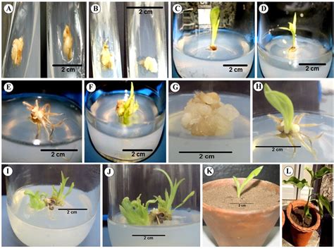 Somatic Embryogenesis and Genetic Fidelity Study of the Micropropagated ...