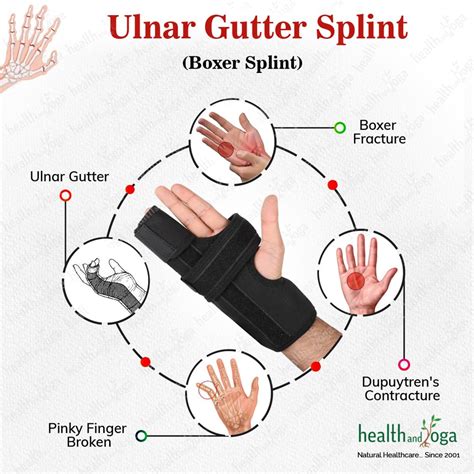 Image result for Finger Gutter Splint