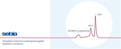 Image result for Sebia Reagent