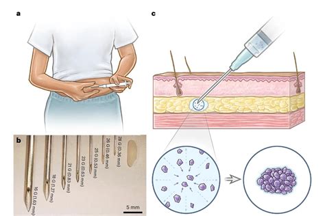 Birth Control Injection 的图像结果
