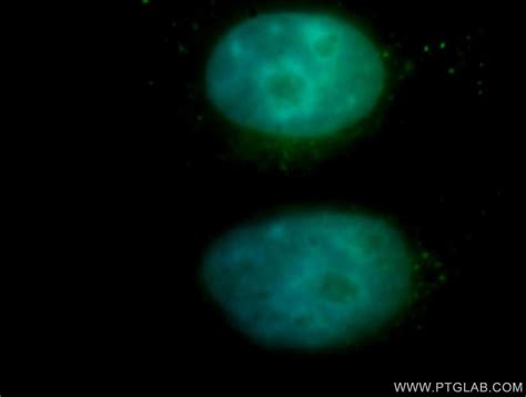 NFE2 antibody (11089-1-AP) | Proteintech