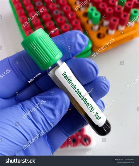 Blood Sample Transferrin Saturationts Test Value Stock Photo 2164042371 | Shutterstock