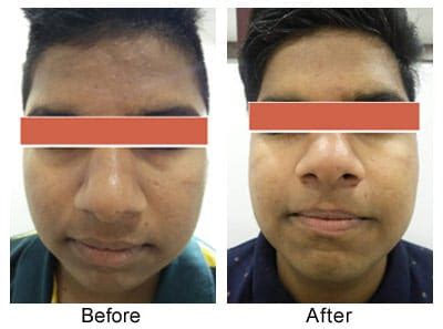 Skin Alive Clinic Nashik