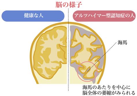 JavaScript Lock Mutex 的图像结果