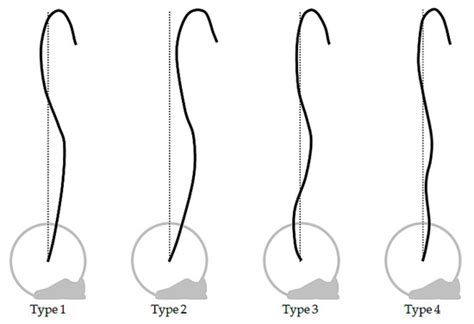 Survey of Barbell Trajectory and Kinematics of the Snatch Lift from the ...