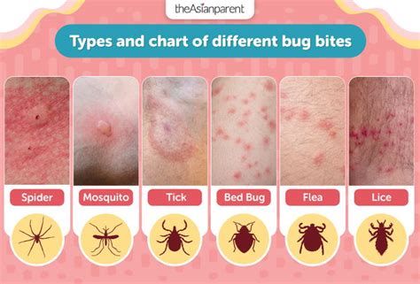 Image result for Bug Bite Identification Chart