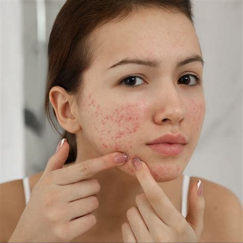 Managing General Skin Disorders With Ayurveda: Natural Remedies And ...