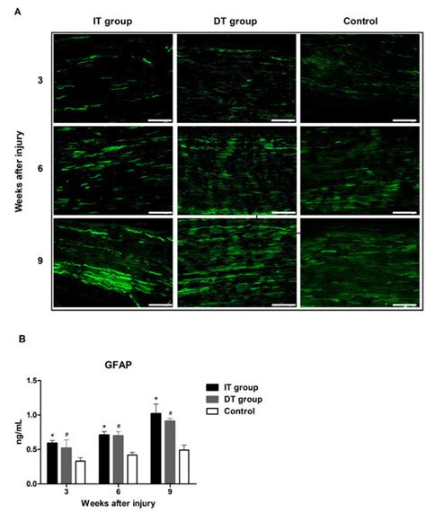 Comparison of Neural Recovery Effects of Botulinum Toxin Based on ...