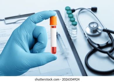 Image result for CSF Sample