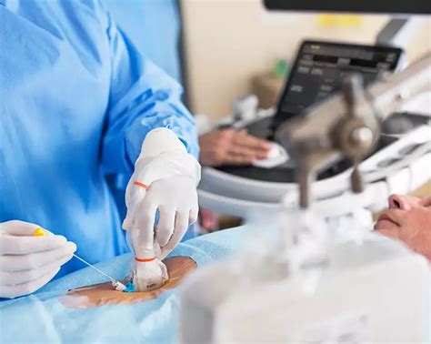 General imaging ultrasound - Philips