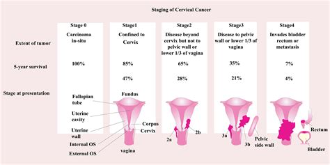Androgens in cervical cancer: Their role in epidemiology and biology: iScience