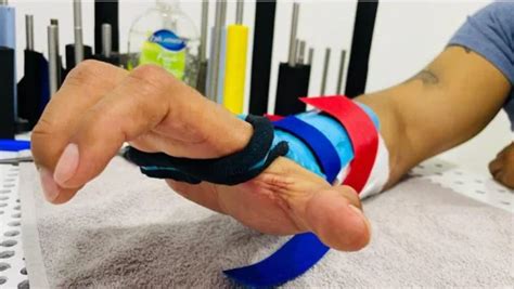 Image result for Splint Material