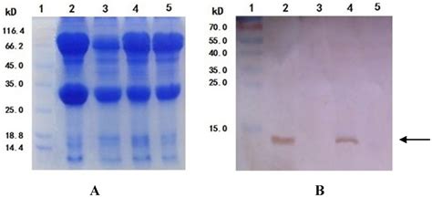 A Shark Liver Gene-Derived Active Peptide Expressed in the Silkworm ...