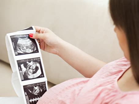 Image result for Fetalscreen II