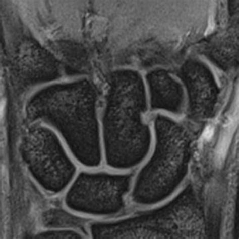 MRI: Wrist joint - DocCheck