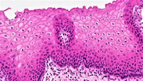 Stratified Columnar Epithelium Tissue | DemaxDe