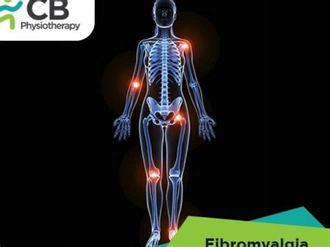 - CB Physiotherapy