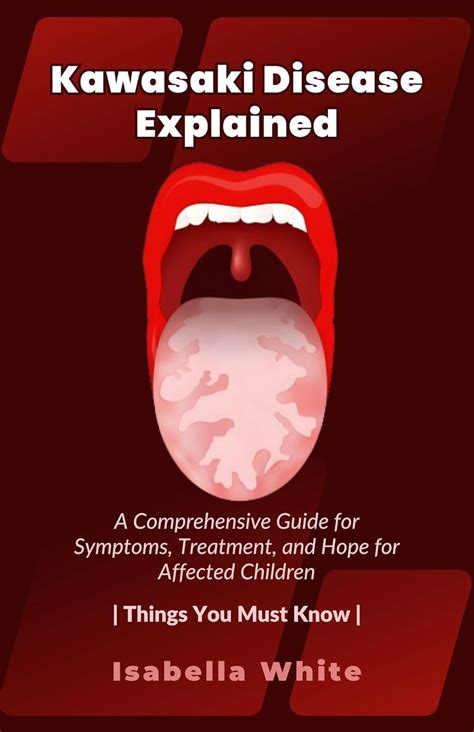 Kawasaki Disease Explained: A Comprehensive Guide for Symptoms ...