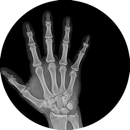 Image result for Arthogram Explained