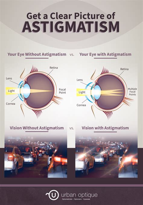 What Does Astigmatism Look Like? | Urban Optique - causes of astigmatism