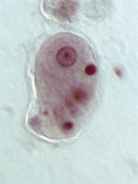 Parasites: Tales of Humanity's Most Unwelcome Guests: Mysteries of Entamoeba histolytica and ...