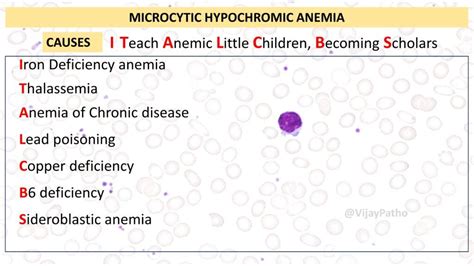 Microcytic Hypochromic Anemia: Causes and Diagnosis - Pathology Made Simple