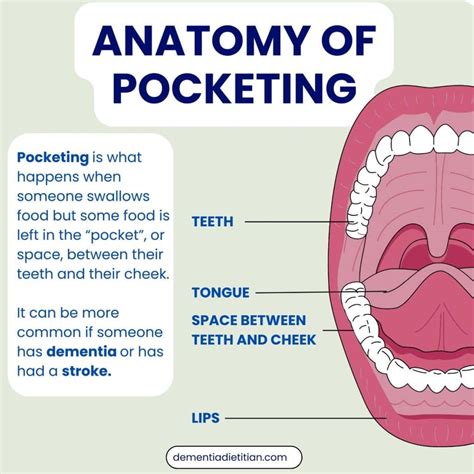 Image result for Gum Paste Pocketing