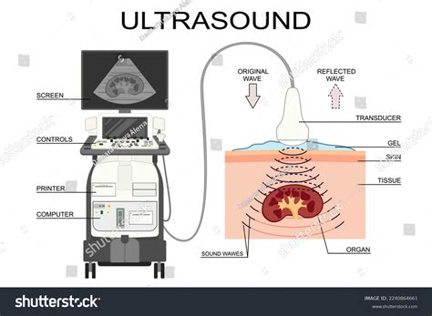 How To Make An Ultrasound Machine At Home at Margurite Stokes blog