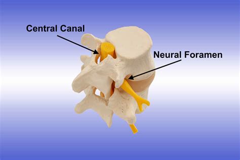 Navigating the Canals of the Spine: Central Canal and Neural Foramen - Spine Info