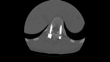 Image Gallery - Revolution HD - Computed Tomography - Products | GE ...