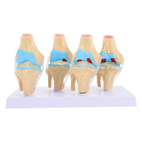 Generic Anatomical Medical Knee Joint With Ligaments Model Knee Joint ...