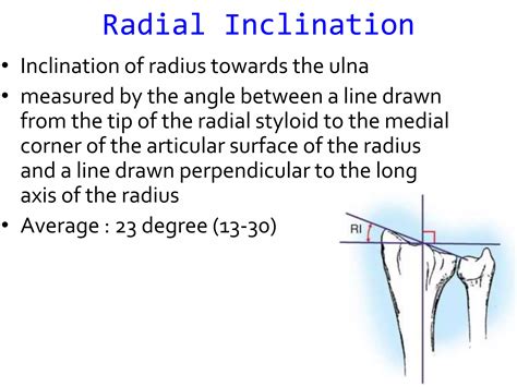 Assessent and radiology of distal end radius fracture | PPTX