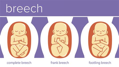 Baby Positions in Womb: What They Mean