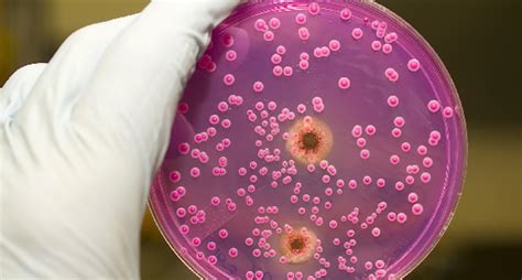 Bildergebnis für candida hiivasieni