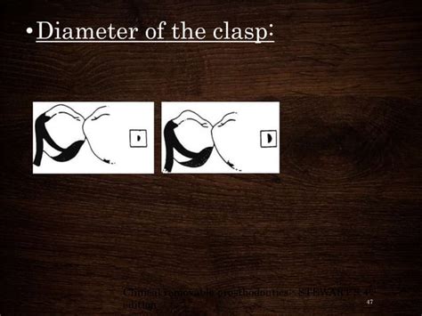 Image result for Clasp Method