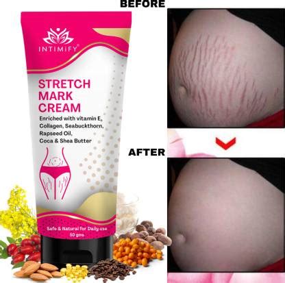 INTIMIFY Pregnancy stretch mark removal cream, Remove Pregnancy Scars ...