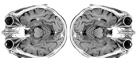 Image result for Python for MRI Data Processing