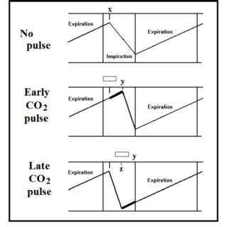 Image result for PCO2 Figure