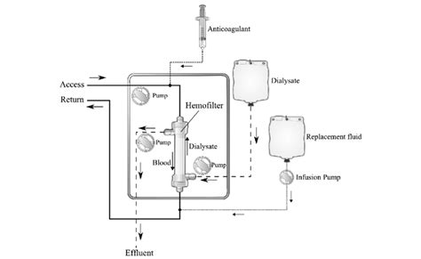 CRRT Recirculation 的图像结果